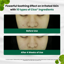 Load image into Gallery viewer, Dr.G R.E.D Blemish Clear Soothing Cream
